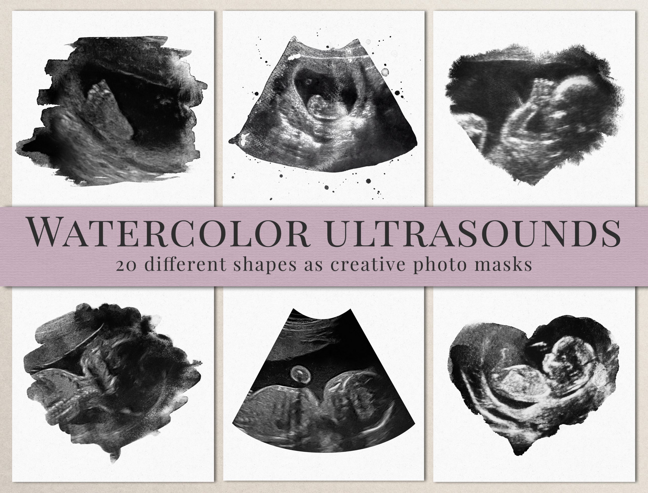 Watercolor ultrasound photomasks